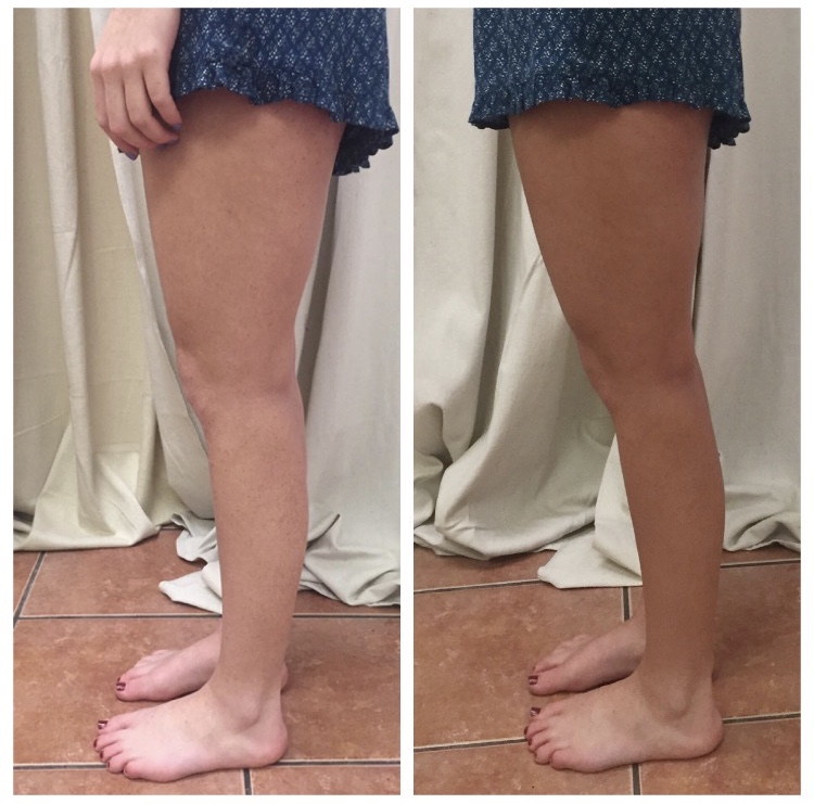 Spray Tanning - before and after